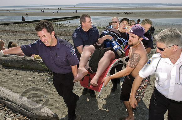 BrokenAnkle060709-04